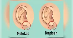 Bentuk Telinga Bisa Ungkap Karakter Tersembunyi yang Dimiliki Seseorang