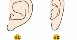 Secara Psikologi, Ternyata Bentuk Telinga Besar dan Kecil Dapat Mengungkap Kepribadian Asli Seseorang, Seperti Apa Tipe Bentuk Telingamu?