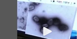 Inilah Perbedaan Virus Mpox dengan COVID 19, Ternyata Beda Waktu Penyebarannya, Berapa Lama?