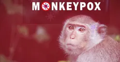 Virus Mpox Mewabah di Indonesia! Begini Gejala Cacar Monyet dan Cara Penularannya, Hampir Sama dengan Cacar Air?