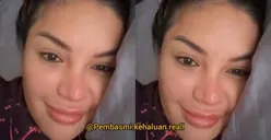Sindir Rekan Artis yang Alasan Operasi Hidung karena Sinus, Nikita Mirzani: Netizen Jangan Mau Dibohongin!