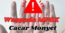 Jumlah Pasien Terinfeksi Virus Mpox di Jawa Barat Tercatat Mengalami Peningkatan Sejak 2023, Ternyata Ini Penyebabnya