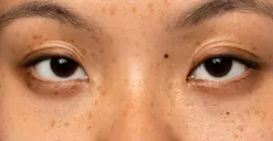 Wajib Coba! 5 Serum Ini Bisa Bantu Pudarkan Flek Hitam, Auto Glowing dan Tampil Percaya Diri!