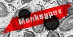Waspada! 3 Kasus Baru Penyebaran Virus Mpox Telah Ditemukan di Dunia, Adakah yang di Indonesia?