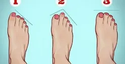 Wahh! Ternyata Bentuk Kaki Bisa Ungkap Karaktermu Lho, Ikuti Tes Kepribadian Berikut Ini!
