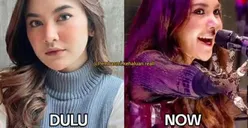 Mahalini Raharja hingga Sarwendah, Deretan Artis yang Operasi Hidung Tapi Malah Dinilai Lebih Bagus Aslinya!