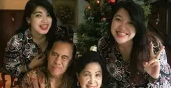 Viral Kisah Dokter Padmosantjojo Berhasil Operasi Yuliana-Yuliani, Bayi Kembar Siam yang Kini Berprestasi