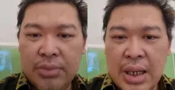 Alvin Lim Minta Mahfud MD Ikut Tangani Korban Kasus Wanaartha Hingga Singgung Hati Nurani