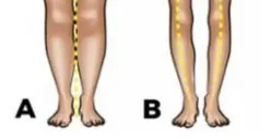 Tes Kepribadian: Watak dan Sifat Aslimu Bisa Terungkap dari Bentuk Kaki, Kamu Termasuk yang Melengkung atau Lurus? Ini Penjelasannya