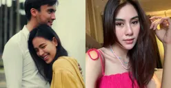 Terungkap! Potret Terbaru Tato Punggung Rendy Kjaernett yang Dahulu Gambar Syahnaz, Warganet: Jadi Pake Taring