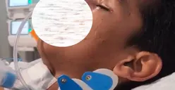 Update David Korban Penganiayaan Sudah Sadar Tapi Emosi Belum Stabil, Gini Tanggapan Sang Ayah!