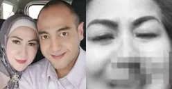 Keaslian Foto Berdarah-darah Venna Melinda Diragukan Pakar Telematika, Ini Tanggapan Hotman Paris 