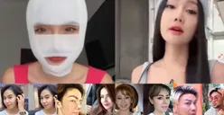 Kaleidoskop 2022: 5 Deretan Artis yang Lakukan Operasi Plastik Sepanjang 2022, Ada yang Sampai Ganti Kepala