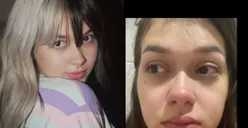 Unggah Kata-kata Jangan Mati Dulu Ya!, Ayah Fadly Faisal Bongkar Soal Kondisi Psikologis Rebecca Klopper 