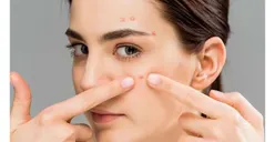 Tips Hilangkan Bekas Jerawat dan Flek Hitam di Wajah dengan 5 Bahan Alami Ini, Nomor 3 Sering Ada di Dapur