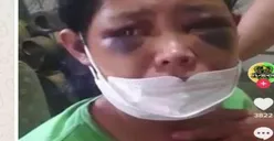 Viral! Dugaan Kasus Penganiayaan ART di Bandung, Hotman Paris Minta Kasus Ditarik ke Polda Jabar!