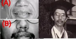 Beredar Isu Ijazah Presiden Jokowi Palsu, Dokter Tifa Ungkap Kejanggalan dari Foto Wisudanya