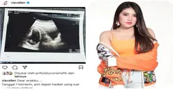 Berharap Jantung Janin Dalam Kandungannya Berdetak, Via Vallen: Hari ke-7 Masih Sunyi