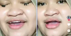 Terungkap Sosok Rehan Begitu Sulit Lupakan di Video Intan Lembata yang Kini Viral di Medsos, Ternyata Begini!