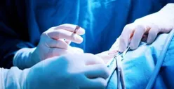 4 Jenis Operasi Bariatrik yang Bisa Menurunkan Berat Badan Kamu Menjadi Ideal Seperti Melly Goeslaw