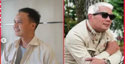 Buntut Rambut Putih Ala Jokowi, Ganjar Pranowo dan Ridwan Kamil Unggah Foto Kocak Rambut Baru