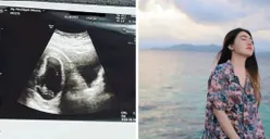 Janin dalam Kandungan Terancam Keguguran, Via Vallen Unggah Foto USG dengan Caption Haru