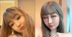 Mengaku Akan Terlihat Seperti Jisoo BLACKPINK, Ini Potret Wajah Lucinta Luna Pasca Operasi Plastik
