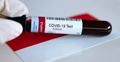 Covid-19 Kota Bekasi Hari Ini: Sembuh 37 Orang, Positif Bertambah 167 Kasus