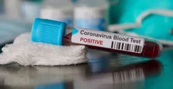Hindari Virus Corona dengan Gaya Hidup Sehat, Hemat dan Simpel!