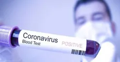 Ini Dasar Hukum Penggelontoran Rp54 Miliar untuk Corona