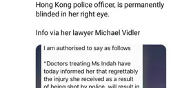 Wartawati yang Tertembak di Hong Kong Alami Kebutaan di Mata Kanan