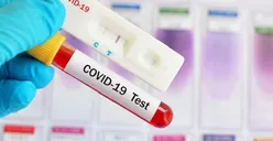 BPOM: Belum Ada Obat Herbal Sembuhkan Covid-19 Berizin