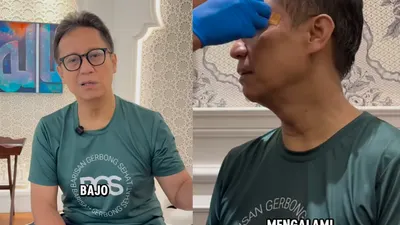 Terpeleset di Kamar Mandi Akibat Hipoglikemia & Alami Luka Robek di Pelipis, Menkes Budi Gunadi Sadikin Beberkan Kronologi Kejadian