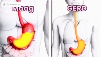 Aman Berpuasa! 6 Tips bagi Kamu yang Punya Asam Lambung agar Tetap Bisa Beribadah di Bulan Ramadhan