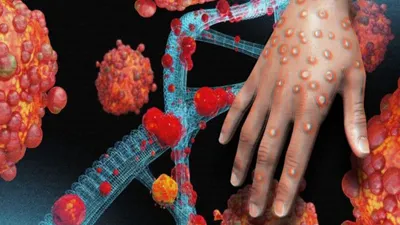 Ilustrasi Virus Monkeypox atau Mpox atau Cacar Monyet