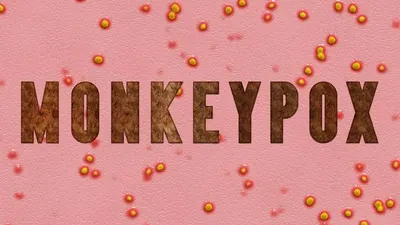 Ilustrasi Monkeypox atau Mpox atau Cacar Monyet