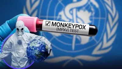 Ilustrasi Mpox atau Monkeypox atau Cacar Monyet