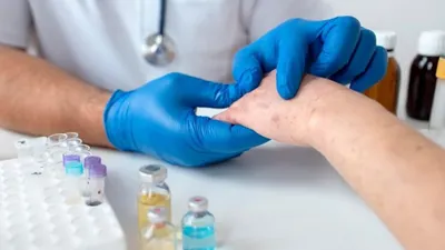 Ramai Soal Wabah Virus Mpox di Indonesia, Ini 5 Fakta Penting yang Wajib Diketahui Masyarakat