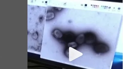 Virus Mpox memiliki beberapa perbedaan dengan Corona atau COVID 19. Salah satunya adalah beda waktu penyebarannya.