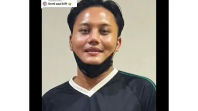 Tak Mau Kalah dari Mahalini Raharja, Rizky Febian Diduga Ikutan Operasi Hidung, Netizen: Kayak Hidung Dipencet
