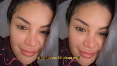 Nikita Mirzani Sindir Rekan Artis yang Alasan Operasi Hidung karena Sinus