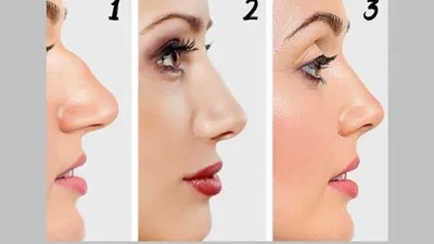 Mengulik Karakter Tersembunyi yang Kamu Miliki Berdasarkan Bentuk Hidung, Pekerja Keras atau Boros?