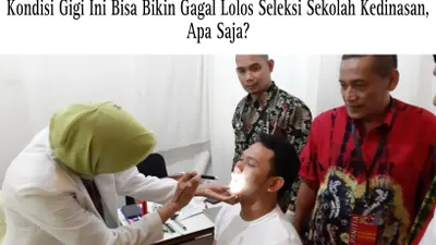 Illustrasi. cek kriteria kondisi gigi seleksi sekolah kedinasan 2024