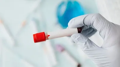 Analisis Pekerjaan yang Cocok Bagi Pemilik Golongan Darah A, B, AB, dan O, Bisa Dapat Cuan Berlipat dan Sukses di Depan Mata