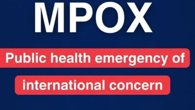Waspada virus Mpox, cacar monyet pada anak