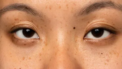 Wajib Coba! 5 Serum Ini Bisa Bantu Pudarkan Flek Hitam, Auto Glowing dan Tampil Percaya Diri!