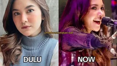Mahalini Raharja ramai disebut operasi hidung