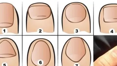 Ini dia 7 kepribadian berdasarkan bentuk kuku jempol. Kira-kira apakah kuku jempolmu cocok dengan kepribadianmu?