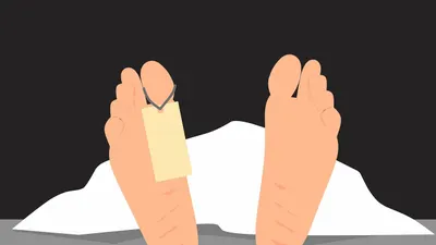 Pihak Unpri melalui Wakil Dekan Fakultas Kedokteran Unpri memberi keterangan jika 5 mayat tersebut adalah Cadaver.