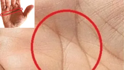 Membandingkan Karakter Orang yang Memiliki Gurat Langka di Telapak Tangannya, Garis X dan Garis Simian